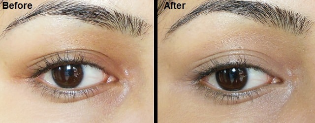 LOreal-True-Match-Super-blendable-Concealer-Light-Medium-Before-After