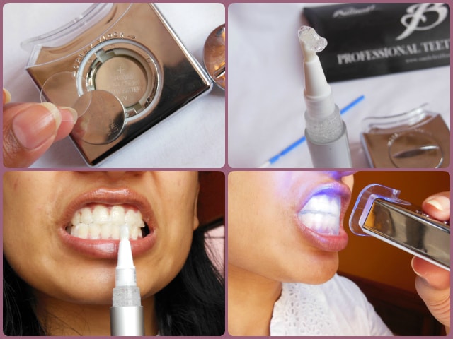 SMILE Brilliant LED Teeth Whitening Kit Demo