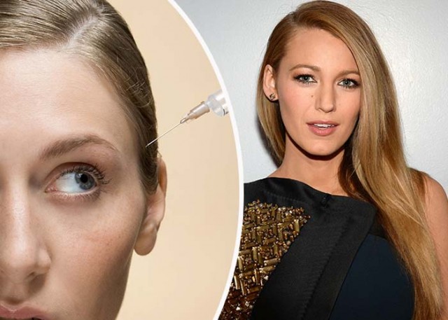 crazy-beauty-trends-ever-scalp-botox